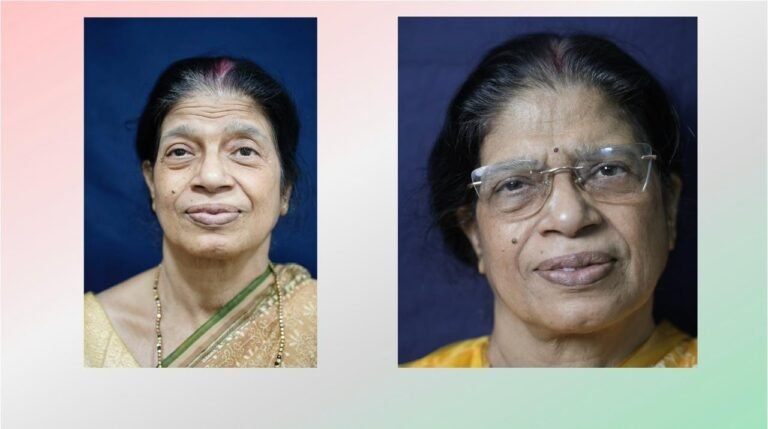 botos treatment in kolkata